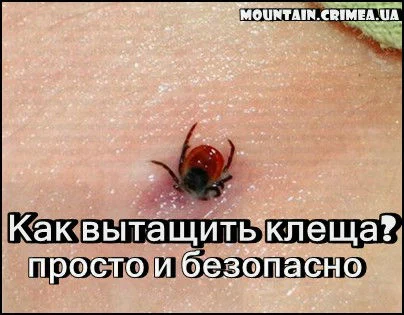 Как вытащить клеща? 3-и способа